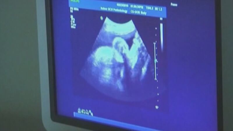 The World Health Organization says there's a worldwide midwife shortage.